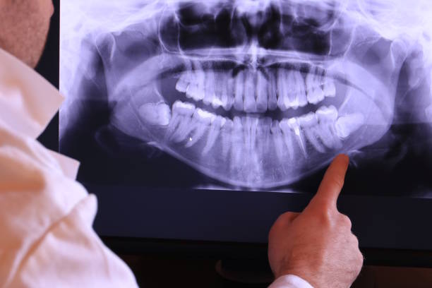 Best Broken or Cracked Tooth Emergency Dentist in Lake Bluff, IL